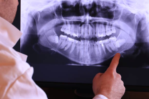 Best Weekend Emergency Dentist in Holgate, OH