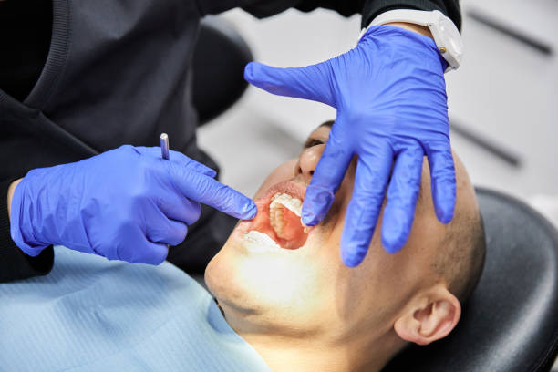 Best Emergency Dental Extractions in Holgate, OH
