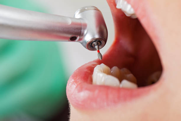 Best Mobile Emergency Dentist in Holgate, OH